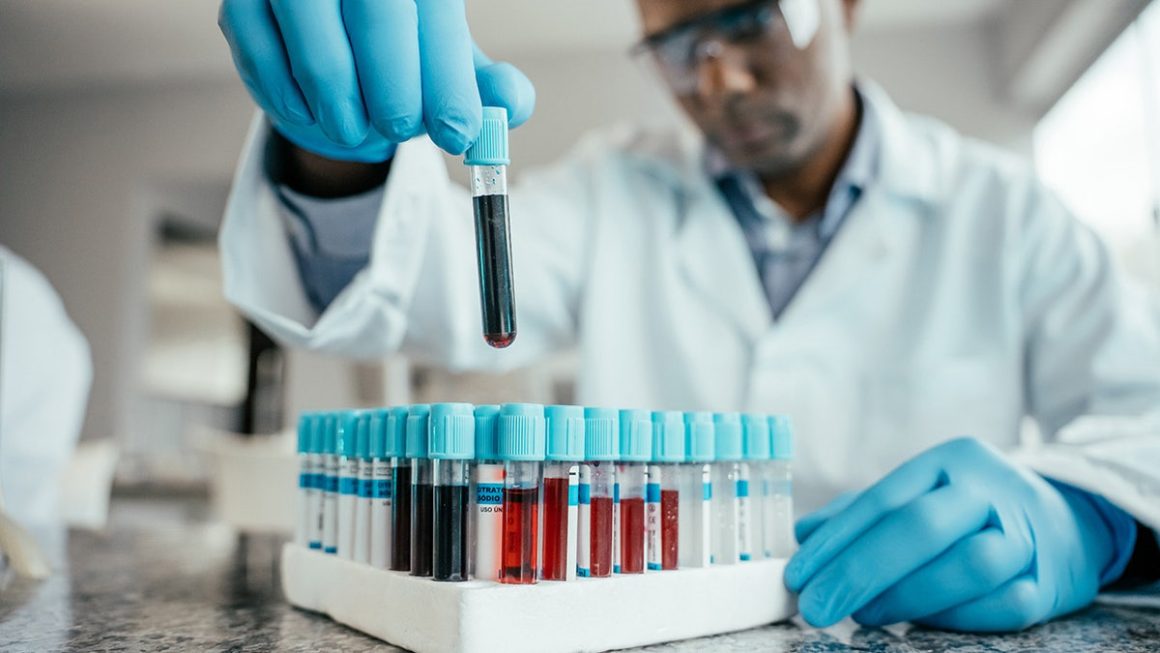 37867654-d863-484b-929c-66dd2aef9a62 Biological Age and Dementia Risk: A New Study