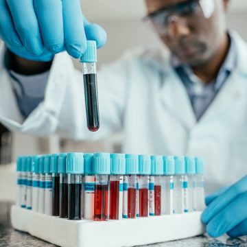 Biological Age and Dementia Risk: A New Study
