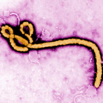 Comparing Ebola and Hantavirus Amid Recent Outbreaks