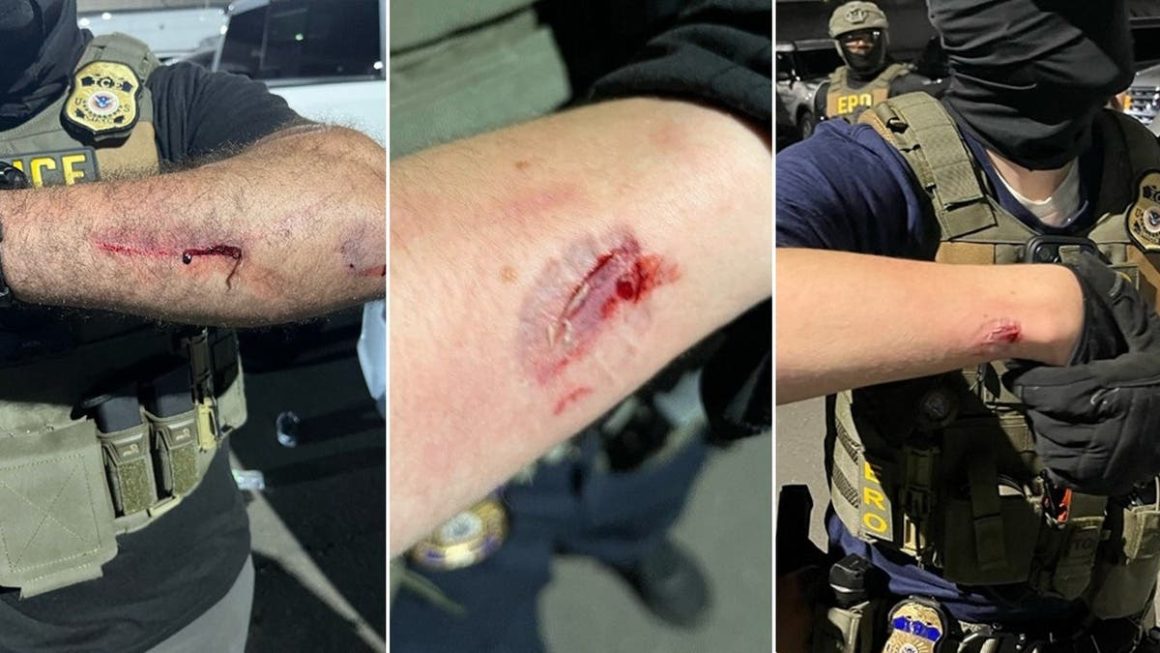 4b5a055b-c7a4-452f-a068-86dd316310d6 Federal Charges After Violent Clashes With ICE Agents