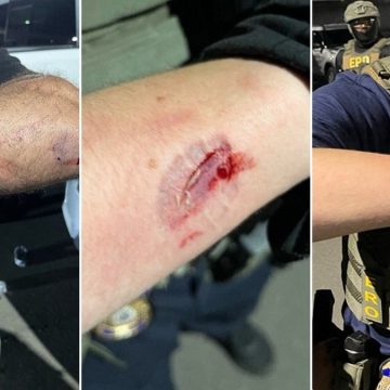 Federal Charges After Violent Clashes With ICE Agents
