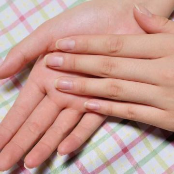 Essential Tips for Maintaining Healthy Nails