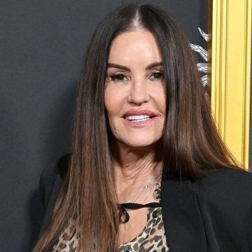 Janice Dickinson’s Transformation with Beverly Hills Surgeon