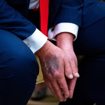 ed65f0c2-c3b9-4c82-b47f-6ef653e16eda Donald Trump Plans Medical and Dental Check-Up at Walter Reed