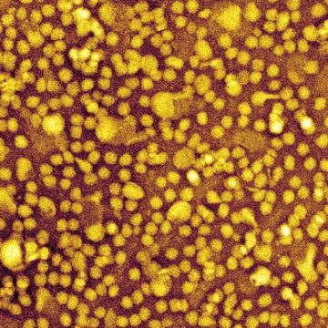 Experimental Gene-Editing Treatment Shows Promise in Lowering Cholesterol