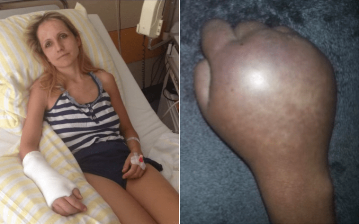 Woman’s Journey through Surgery and Chronic Pain