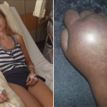 Woman’s Journey through Surgery and Chronic Pain