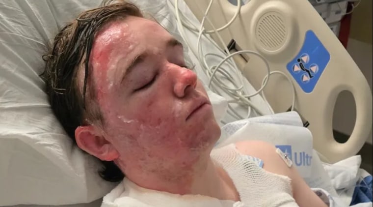 986f90b1-fd7c-47b9-8422-9edbdbd5bc53 California McDonald’s Employee Suffers Severe Burns in Workplace Incident