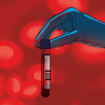 Advanced Blood Tests: Revolutionizing Cancer Screening
