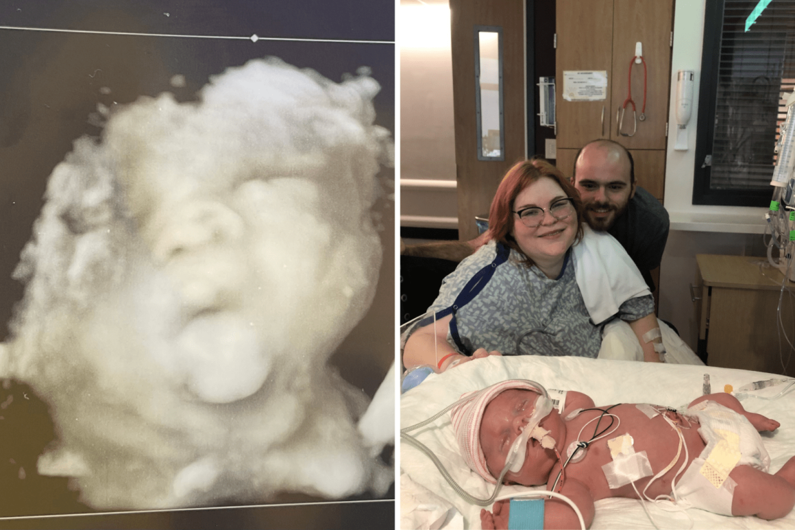 0e658184-1ed1-4ac9-9fbd-67ebcffbe839 Navigating Life with Osteogenesis Imperfecta: A Mother’s Story
