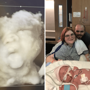 Navigating Life with Osteogenesis Imperfecta: A Mother’s Story