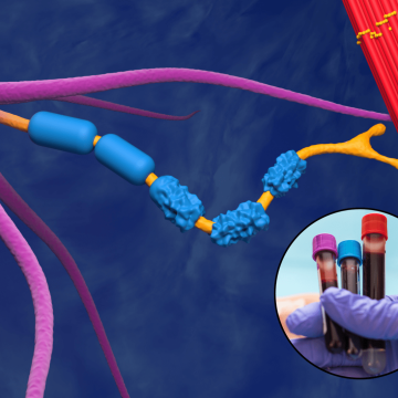 Breakthrough in ALS Research: Early Detection through Blood Proteins