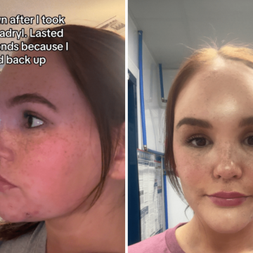 Oklahoma Woman’s Bug Bite Leads to Medical Crisis
