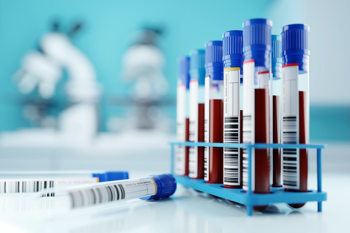 New Research on Blood Sample Analysis for Colorectal Cancer Tracking