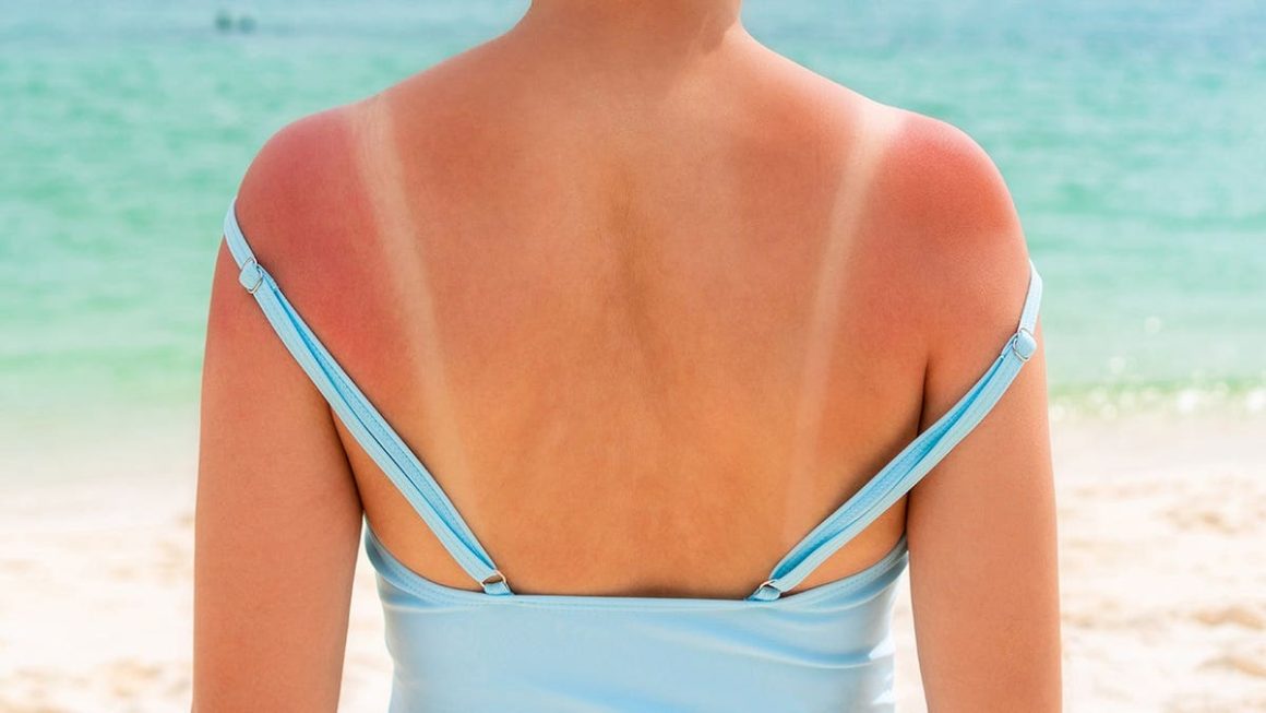 Dermatologists Warn Against ‘Tanmaxxing’ Trend Among Gen Z