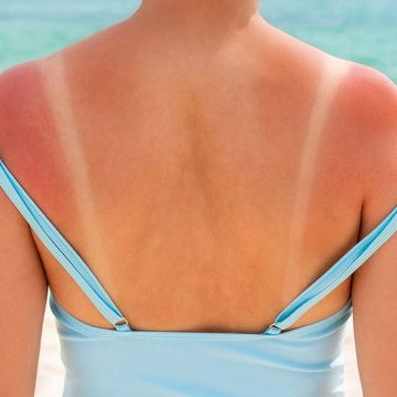 Dermatologists Warn Against ‘Tanmaxxing’ Trend Among Gen Z