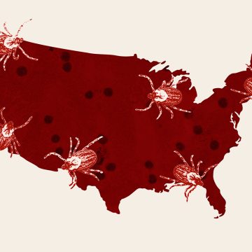 Summer Tick Threats and Their Implications
