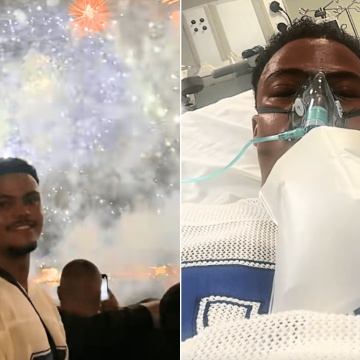 Man’s Birthday Celebration Turns Into Fight for Survival After Allergic Reaction
