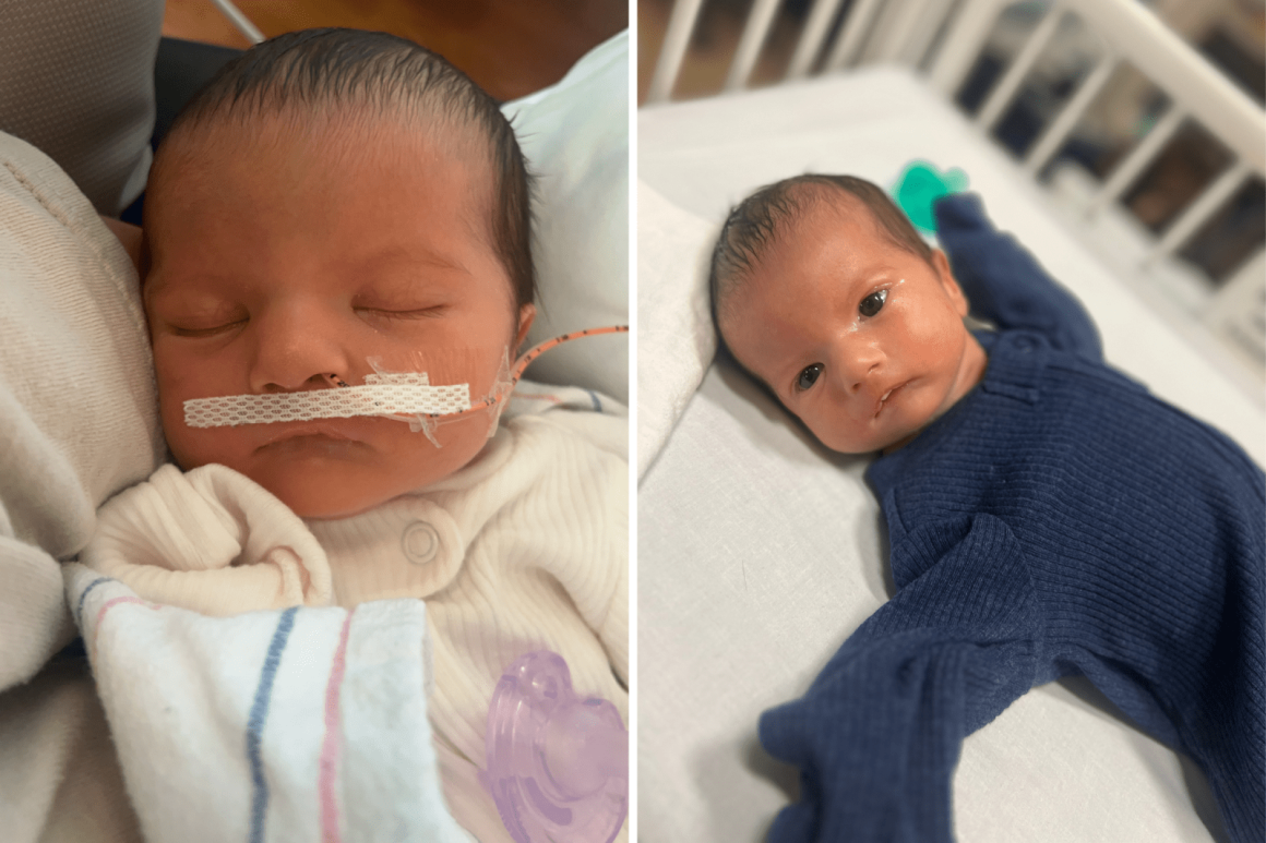 Mother Shares Journey About Her Son’s Rare Condition, Poland-Moebius Syndrome