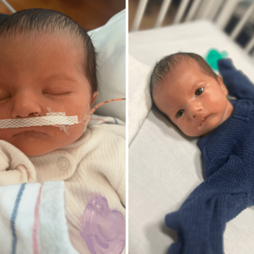Mother Shares Journey About Her Son’s Rare Condition, Poland-Moebius Syndrome