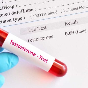 1b65b78d-5f81-43e6-9811-8afce392a3cc The Growing Focus on Testosterone Screening and Therapy