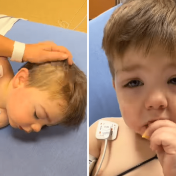 Child’s Quick Recovery After Severe Allergic Reaction to Fire Ant Bites