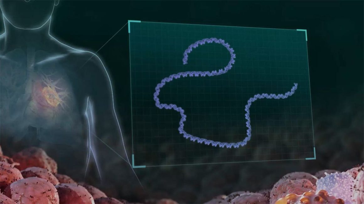 Experimental Skin Cancer Vaccine Shows Promise in Reducing Melanoma Recurrence