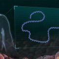 Experimental Skin Cancer Vaccine Shows Promise in Reducing Melanoma Recurrence
