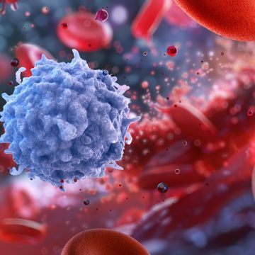 Blood Cells Point to Potential in Melanoma Treatment Prediction