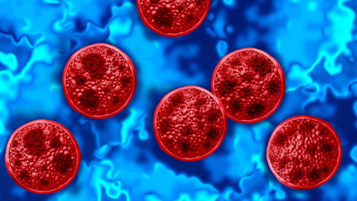 Surge in Cyclosporiasis Outbreak Across 41 States
