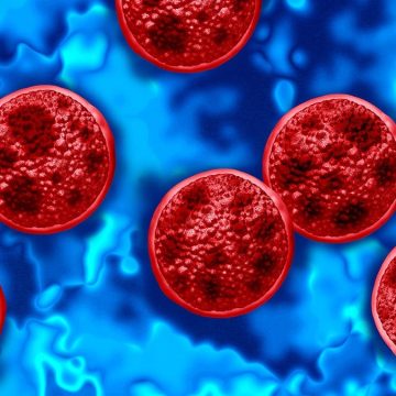 8e29689b-45c9-4955-9a4d-dffefb7845f0 Surge in Cyclosporiasis Outbreak Across 41 States