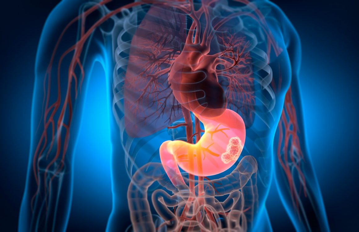 Innovative SHIFTERS Approach Enhances CAR-T Therapy for Solid Tumors
