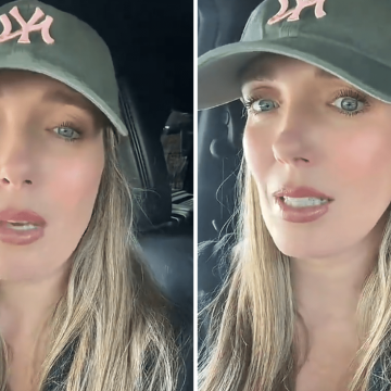 Woman Warns of Botox Risks After Experiencing Severe Side Effects