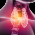 Routine Checkup Uncovers Hidden Thyroid Cancer