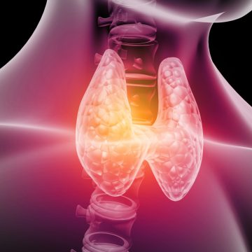 Routine Checkup Uncovers Hidden Thyroid Cancer