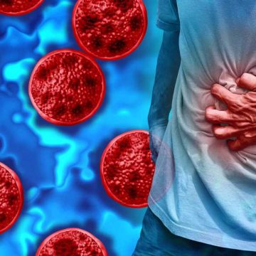 Cyclospora Parasitic Outbreak in the U.S.