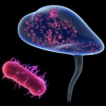 Understanding Urinary Tract Infections and Their Recurrence