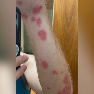Florida Man Claims Lion Diet Saved His Life