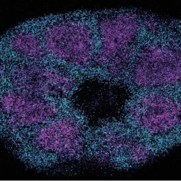 New Insights Into Protein Interactions Linked to Profound Autism