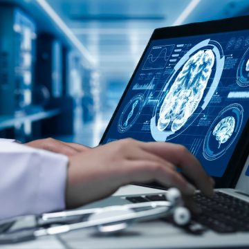 Diet’s Role in Reducing Alzheimer’s Risk