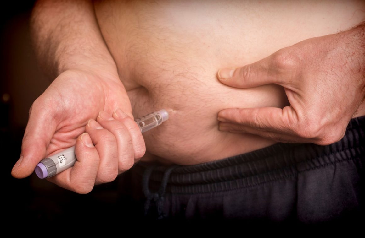 Genetic Links Between Weight-Loss Drugs and Hair Loss