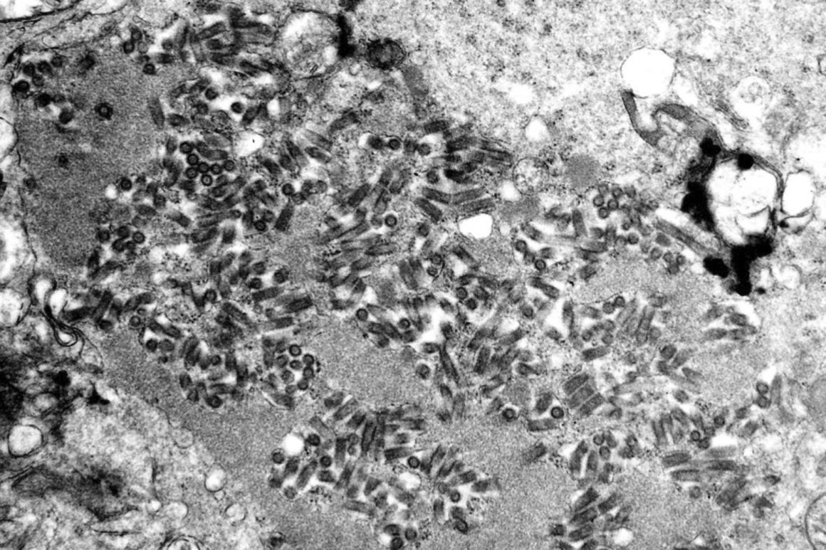 Rabies Warnings Issued Amid Rise in Animal Cases Across Multiple States