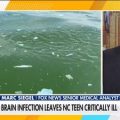 Brain-Eating Amoeba Claims Child’s Life, Teen in Critical Condition