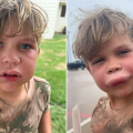 Understanding the Risks of Insect Stings: A Mother’s Experience