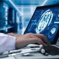 Study Links Epilepsy to Higher Risk of Young-Onset Dementia
