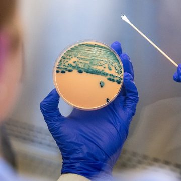 Shigella Infection: Rising Drug Resistance Raises Concerns