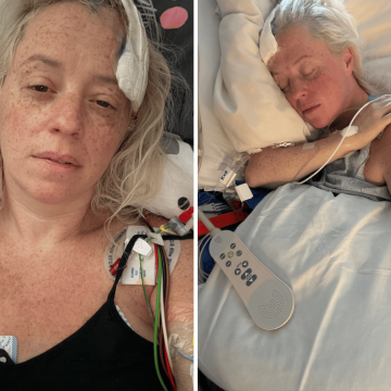 A Personal Battle with a Ruptured Brain Aneurysm