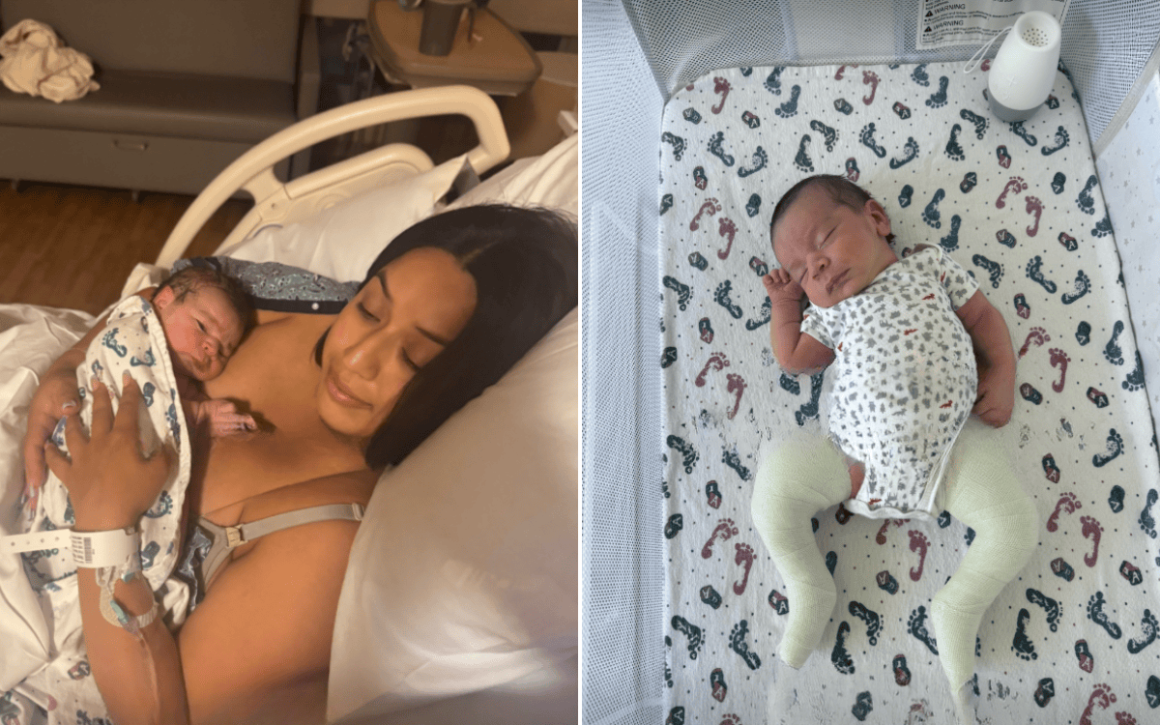 A Mother’s Journey with Her Son’s Clubfoot Condition
