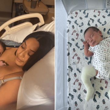 A Mother’s Journey with Her Son’s Clubfoot Condition