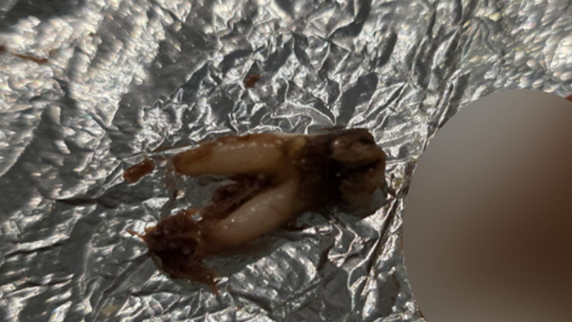 fd72eb68-9faa-44c2-bab1-1577a08d6b3b Customer Discovers Cow Tooth in Taco, Files Lawsuit Against Torchy’s Tacos